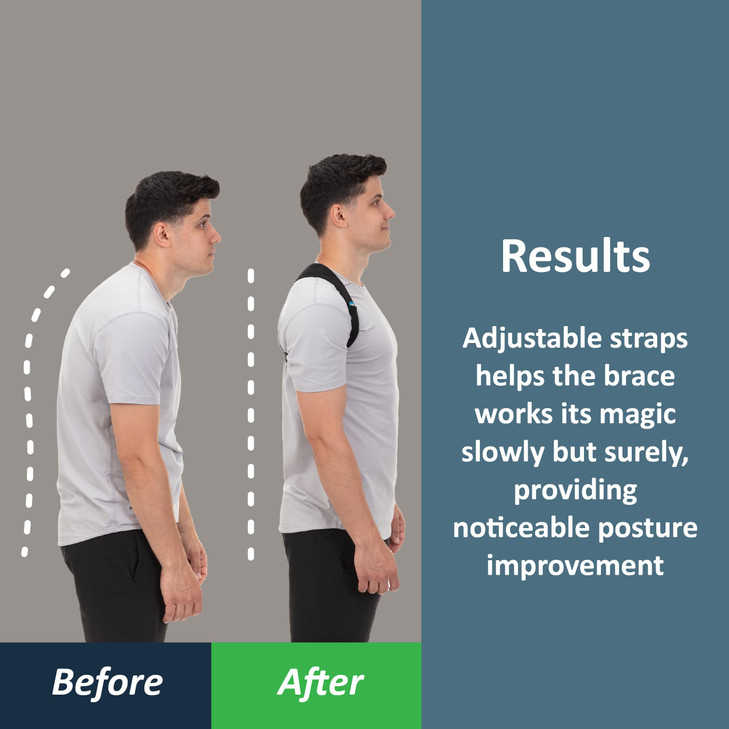 ComfyBrace Posture Corrector-Back Brace for Men and Women- Fully Adjustable