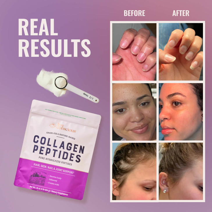 Live Conscious Collagen Peptides Powder Unflavored Packets-Hydrolyzed Collagen