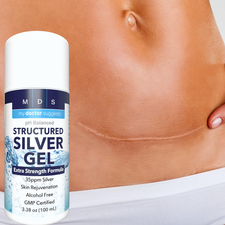 My Doctor Suggests Structured Colloidal Silver Gel Extra Strength