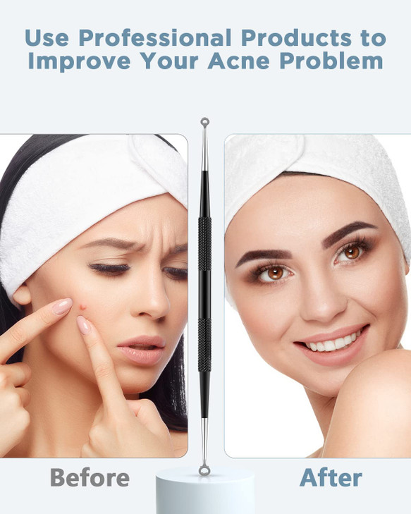 TAYTHI Blackhead Remover Tool, Pimple Popper Tool Kit, Blackhead Extractor Tool for Face, Extractor Tool for Comedone Zit Acne Whitehead Blemish, Sta