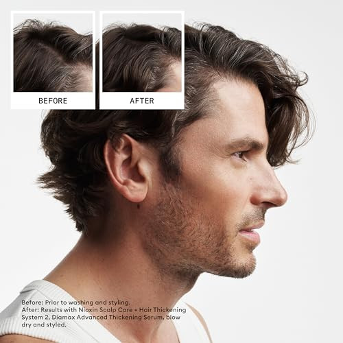 Nioxin Scalp Hair Thickening System 2 Conditioner For Natural or Untreated Hair with Progressed Thinning With Niacinamid
