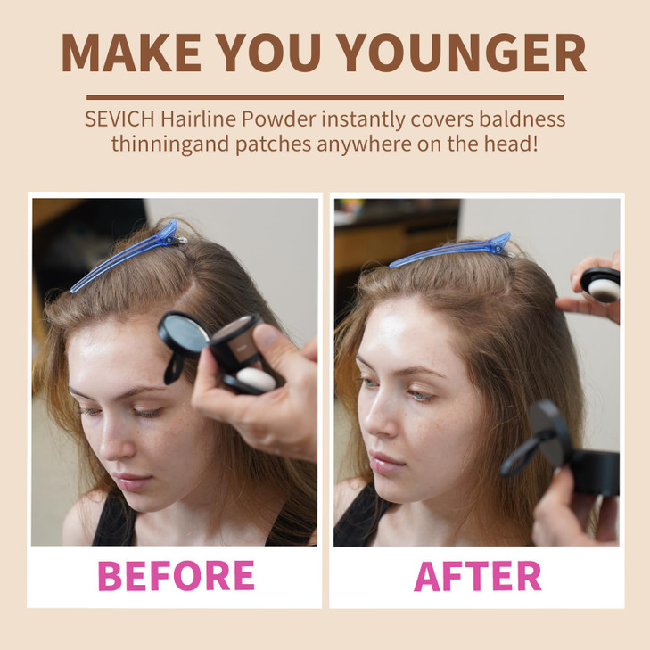 Sevich Hairline PowderInstantly Conceals Hair Loss Root Touch up Powder Hair Shadow Toppers for Women Men Touch Up for T