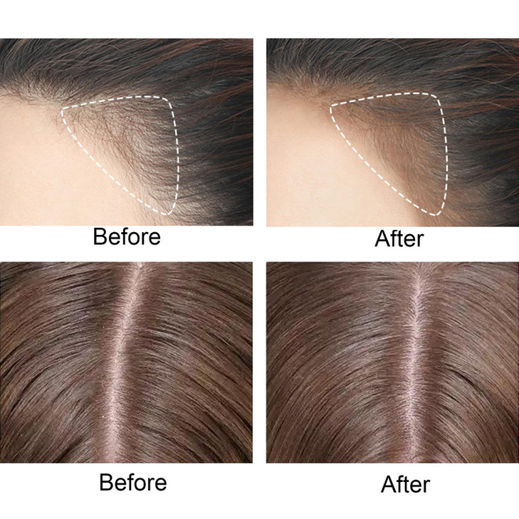 Hairline Powder Stick Hairline Contouring Shadow Powder Stick for Women Men Instantly Conceals Hair Loss Thinning Hair B