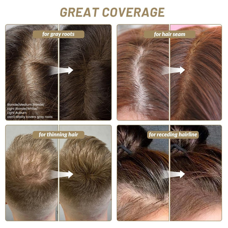 SOVONCARE Hairline Powder Root Touch Up Gray Hair Concealer for Men and Women Instantly Covers Thinning Hair and Bald Sp
