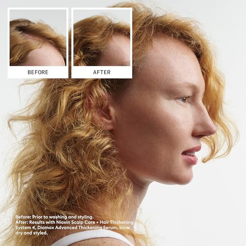 Nioxin System 4 Scalp Hair Thickening Treatment Serum for Colored or Damaged Hair with Progressed Thinning 68 Fl oz