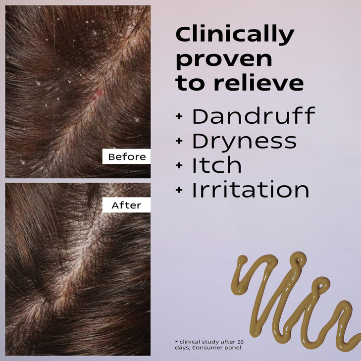 KAMEDIS Scalp Moisturizer Lotion For Dry Itchy Dandruff Flaky Sensitive Scalp OverNight Mask Treatment BotanicalsBased P