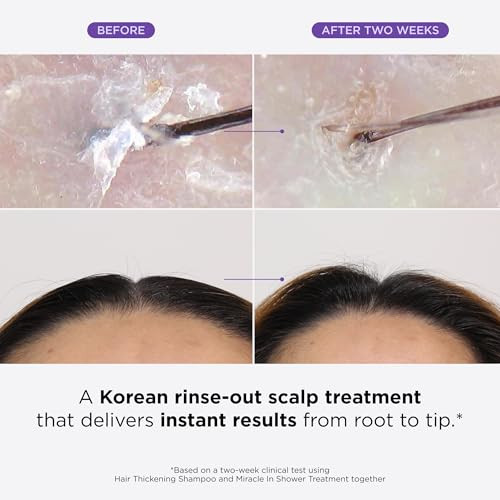 Dr Groot Miracle in Shower Moisturizing Treatment for Hair Loss Korean Hair Care Rinse Rosemary Oil for Smooth Healthier