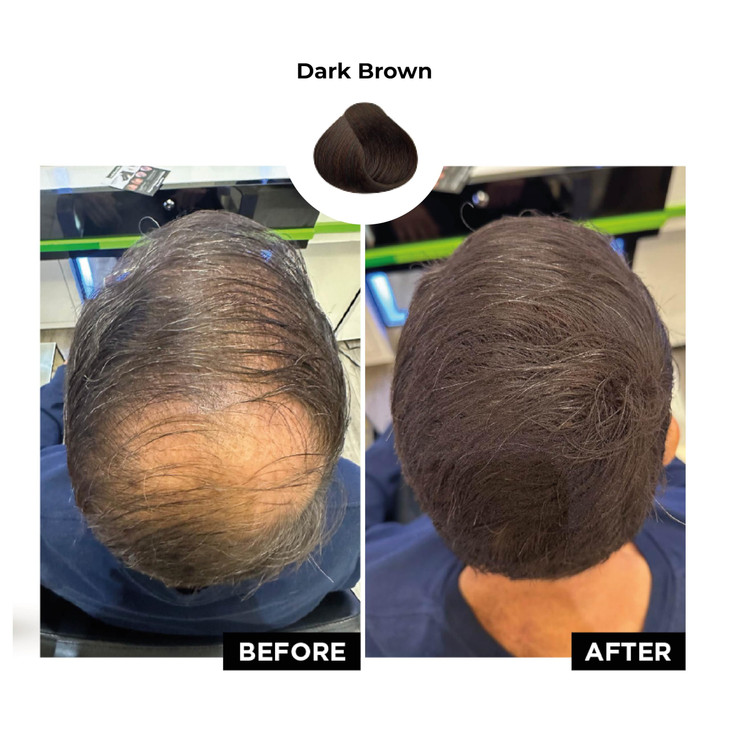 HAIRATIN Building Fibers for Thinning Hair Dark Brown 28G Achieve Fuller Natural Looking Results Instantly Conceals Hair