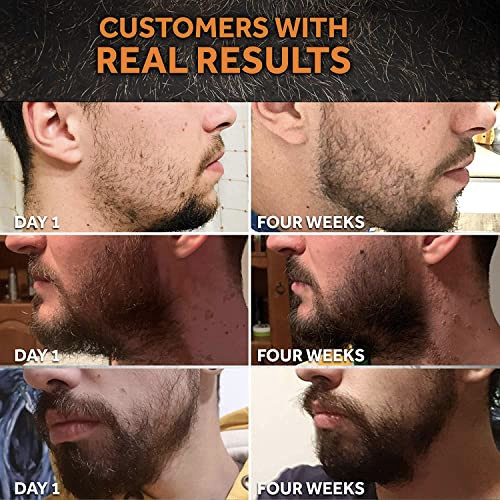 Beard Growth Oil 1Fl Oz Growing Serum That Softens Strengthens Beards and Mustaches Facial Hair Treatment Treatment Infu