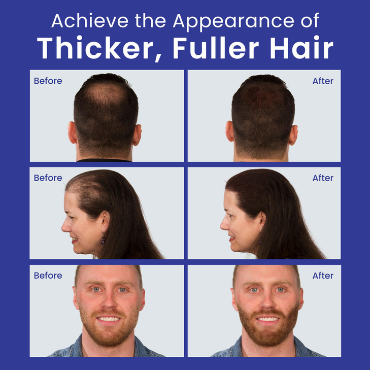 INFINITY Hair Fibers Dark Brown for Thinning Hair for Women Men 100 Undetectable Hair Building Fiber Powder Conceal Hair