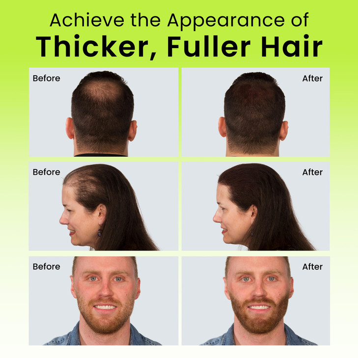 ECLIPSE Hair Fibers Medium Brown for Thinning Hair for Women Men to Conceal Hair Loss in 15 Seconds 100 Undetectable Hai