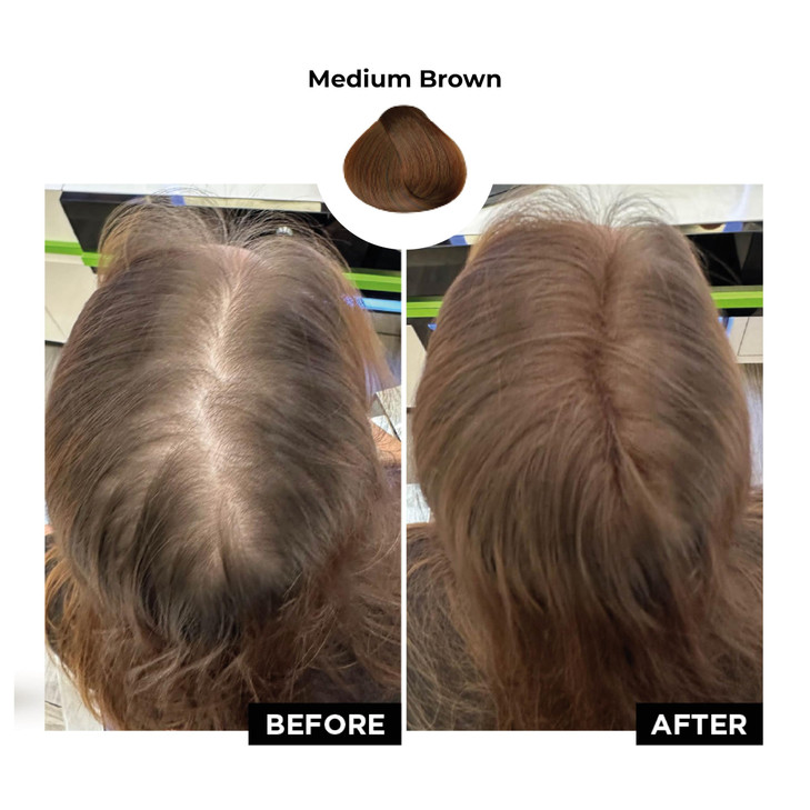HAIRATIN Building Fibers for Thinning Hair Medium Brown 28G Achieve Fuller Natural Looking Results Instantly Conceals Ha