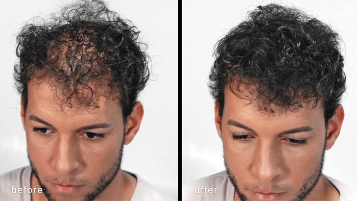 MAXX PROSERIES Volumizing Hair Fibers with real Keratin for Thinning HairHair Loss Dermatologist Tested and Certified Hy