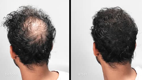 LUXE Hair Building Fibers Thickening Fibers CONFIDENCE IN A JAR 2 Months Supply Hypoallergenic Dermatologist Tested Mult