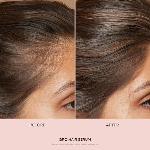 VEGAMOUR GRO Hair Serum for Hair Thinning Thicker Fuller Looking Hair Non Oily Tonic for Healthier Scalp 30 day Supply 1