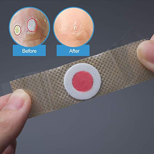 Reppkyh Corn Remover, 36 PackCorn Remover Pads, High Efficacy Corn Pads, Toe and Callus Corn Removal, Best Corn Remover Pads for Foot Corn Removal