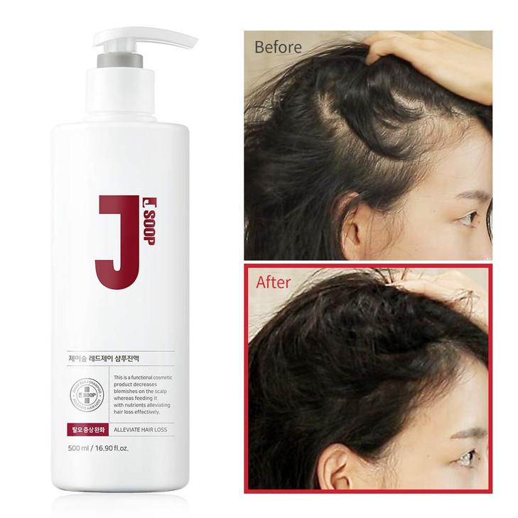 JSOOP Red J Shampoo 500ml169 floz Antihair loss Low skin irritation Reduces redness of the scalp