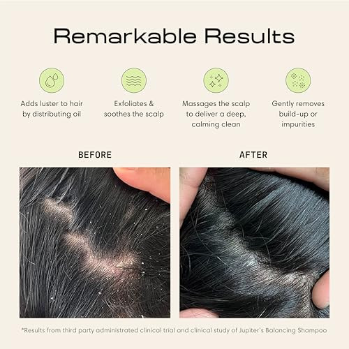 Jupiter Scalp Exfoliator Scalp Massager Tool for Wet Dry Hair Ergonomic Detangler Brush Dandruff Comb Scrub to Remove Da