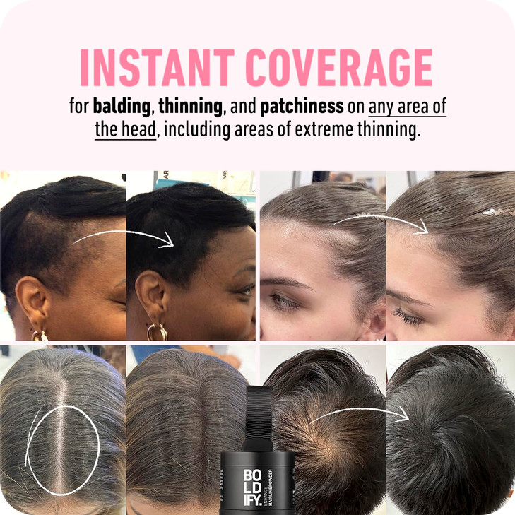 Boldify Hairline Powder Hair Fiber Dark Brown bundle that Instantly Conceals Hair Loss Hair Powder for Thinning Hair Roo