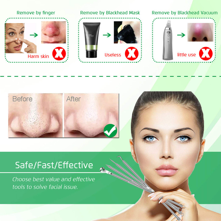 5PCS Blackhead Remover Comedone Extractor Curved Blackhead Tweezers Kit Professional Stainless Pimple Acne Blemish Remov