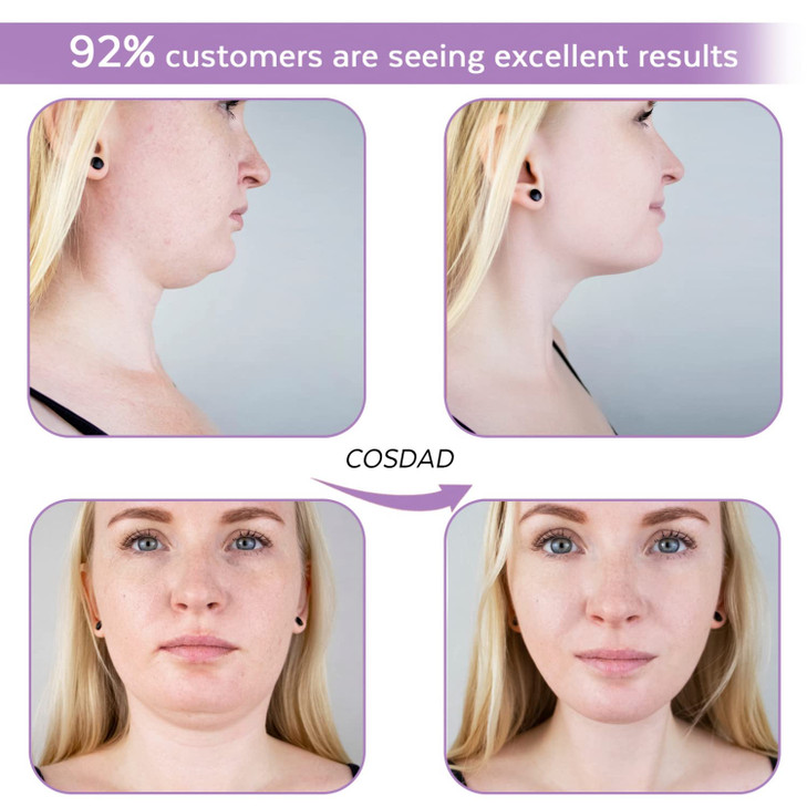 COSDAD Reusable Double Chin Reducer Chin Strap Face Slimming Strap Face Slimmer Shaper for WomenBreathable Comfortable V