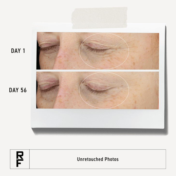 RODAN FIELDS Redefine Eye Cream 15 ml Vitamin C F Moisturizer for Hydrated Radiant Eyes Supports Younger Looking Eyes Sm