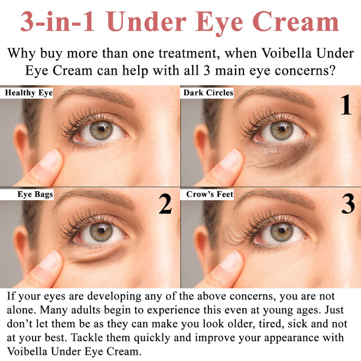 Under Eye Cream with Retinol Peptides Hyaluronic Acid Aloe Advanced Repair Formula for Puffiness Bags Dark Circles Dry U