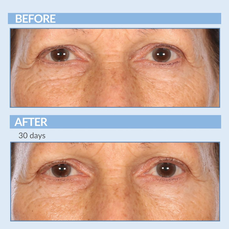 Serious Skincare Retinol A Eye XR Under Eye Cream Concentrate Reduce Fine Lines Dark Circles Puffiness Daily Wrinkle Cre