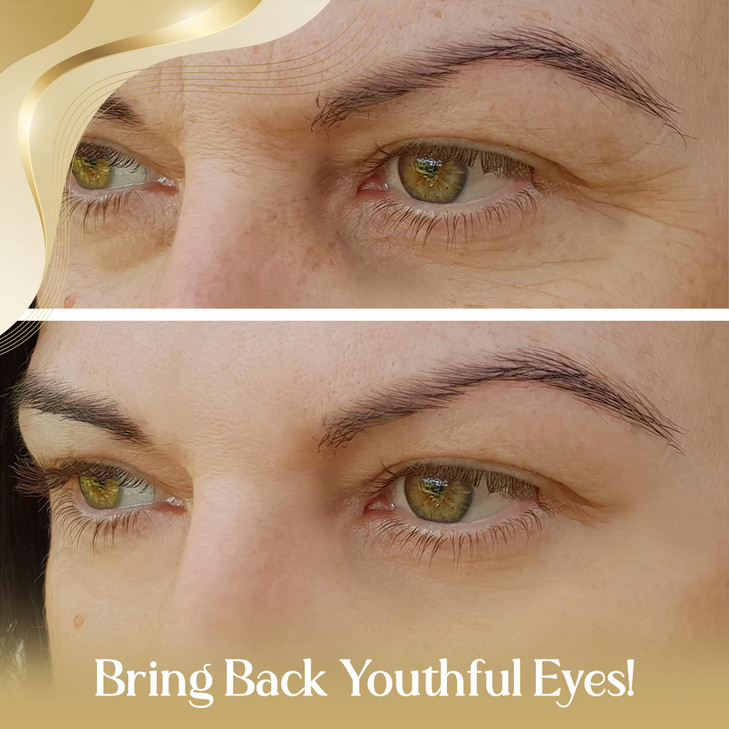 OROGOLD 24K Intensive Eye Serum Under Eye Serum to Help Reduce the Look of Dark Circles and Puffiness Gold Green Tea Alo