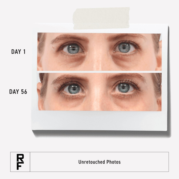 RODAN FIELDS Active Hydration Bright Eye Complex 15ml Moisturizing Under Eye Cream for Dry Skin Eye Treatment for Refres