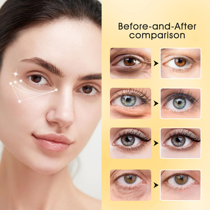 Adofect Under Eye Patches 30 Pairs 24K Gold Under Eye Mask with Hyaluronic Acid for Dark Circles and Puffy Eyes Collagen