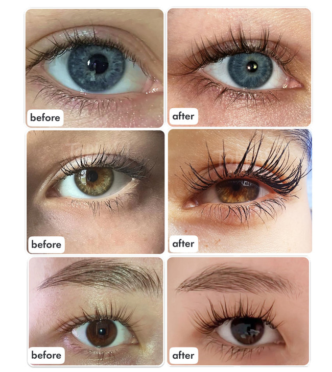TOPLASH XL Lash and Brow Booster Growth Serum with Eyelash and Eyebrow Enhancer Promotes Stronger Thicker Healthier Lash