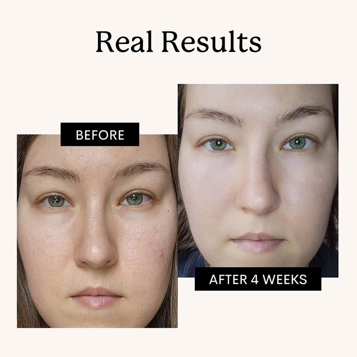 FLEUR BEE Retinol Moisturizer Clean 100 Vegan Anti Aging Cream Retinol Cream for Face Best for Night and Day For Women a