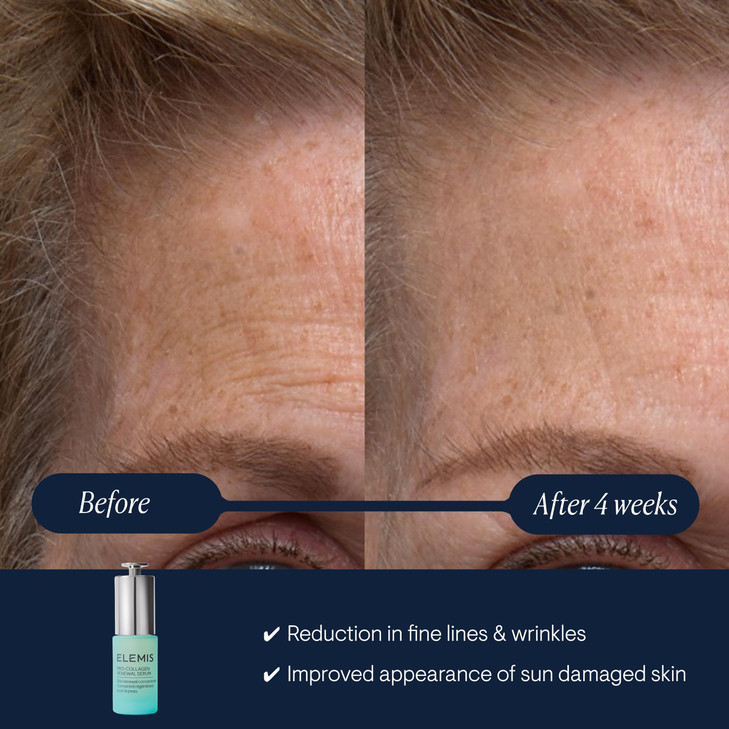 ELEMIS ProCollagen Renewal Serum 15ml Gentle Retinol Alternative for Smoothing Fine Lines Wrinkles