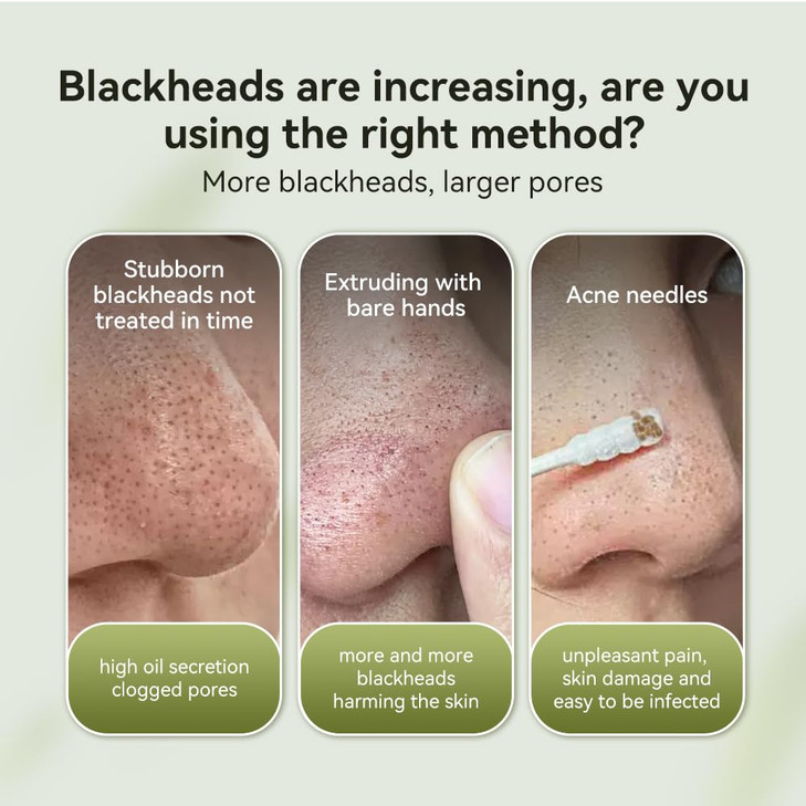 LANBENA Blackhead Mask Nose Plants Pores Strips Blackhead Remover Mask Peel off Mask Facial Pore Cleanser Purifying Face