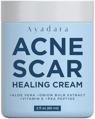 AYADARA Acne Scar Cream 2 fl oz Moisturizing Face Body Cream for Face Stretch Acne Marks Hydrating Formula for All Skin