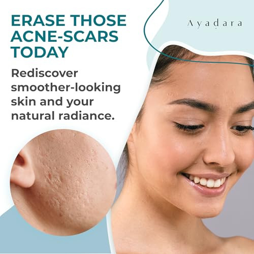 AYADARA Acne Scar Cream 2 fl oz Moisturizing Face Body Cream for Face Stretch Acne Marks Hydrating Formula for All Skin