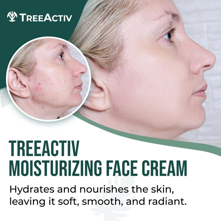 TreeActiv Acne Eliminating Face Cream Tea Tree Moisturizing Formula for Balanced FreshLooking Skin Suitable for Sensitiv