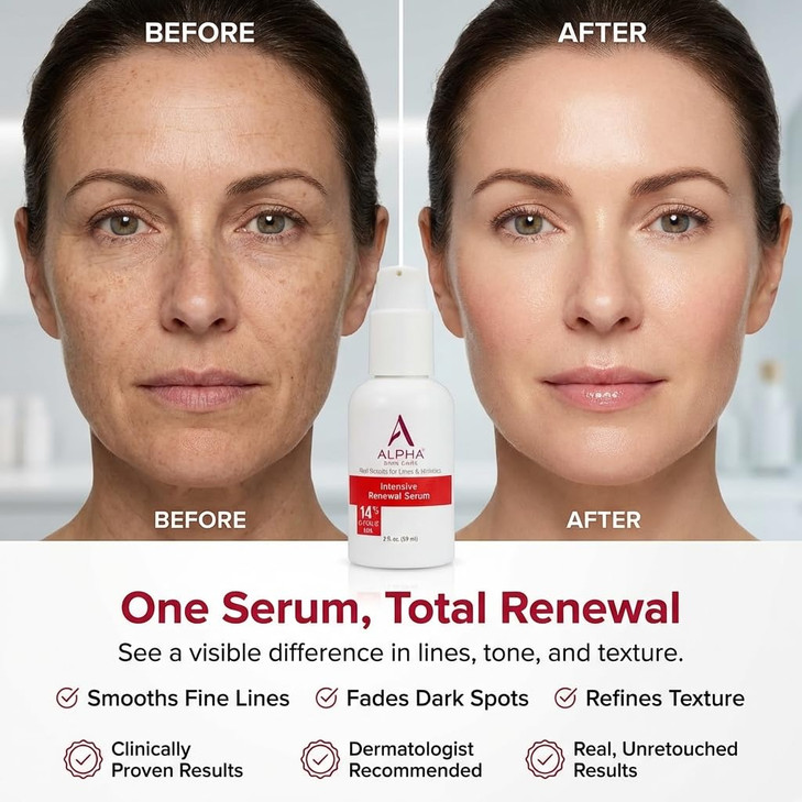 Alpha Skin Care Renewal Serum 14 Glycolic AHA AntiAging Formula Reduces Lines Wrinkles Alpha Hydroxy Acid Exfoliates Eve