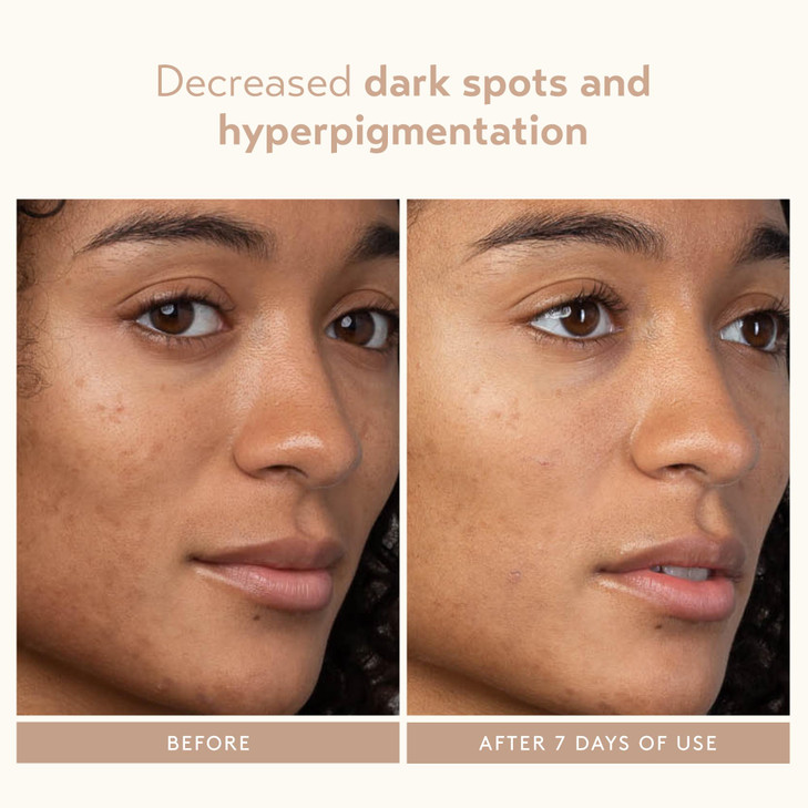SHANI DARDEN SKIN CARE Lactic Acid Face Serum Active Night Serum to Help with the Look of Radiant and Smooth Skin Gentle