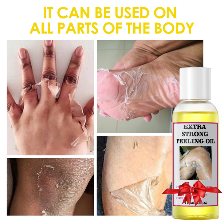 YAFUSIPE Yellow Peeling Oil for Dark Skin Strong Peel Oil Extra Strength Exfoliating Chemical Exfoliant Peels Solution a