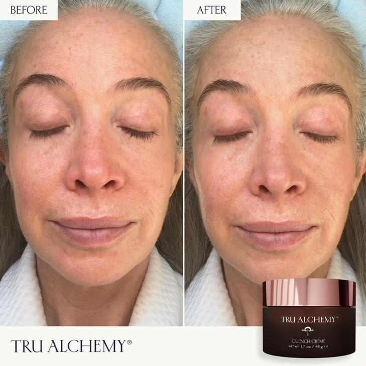 Tru Alchemy Quench Crme Daily Facial Moisturizer Hyaluronic Acid Vitamin C Bakuchiol better than Retinol Daily Firming S