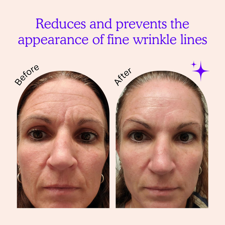 BLUMBODY Face Forehead Wrinkle Patches Anti Wrinkle Facial Patches to Smooth Eye Mouth Forehead Wrinkles NonSilicone Fac