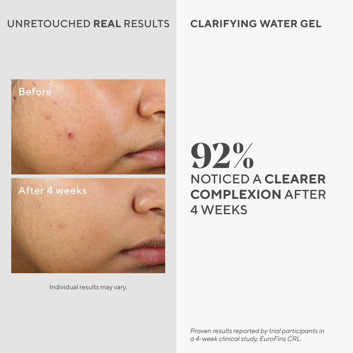 Murad Clarifying Water Gel Lightweight Face Moisturizer for AcneProne Skin with Salicylic and Hyaluronic Acid for Breako