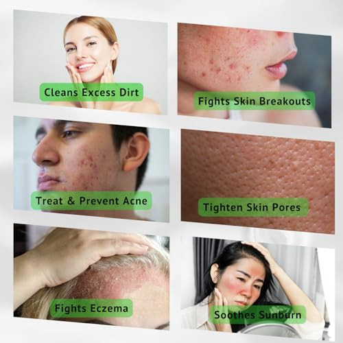 iMMense Naturals Aloe Vera Toner for Face Skincare to Treat and Prevent Acne Restore PH Balance Excess Dirt Facial Toner