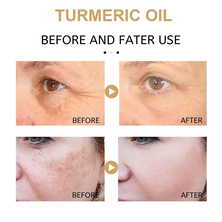 2Pack Turmeric Corrector Serum Natural Turmeric Repair Face Serum for Face Hydrate and Dry Skin