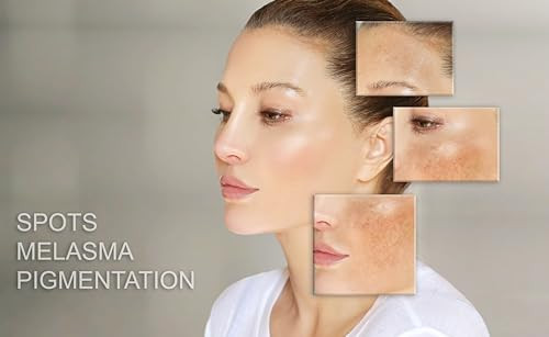 MT Skin Clinic Day Cream Moisturizer for Face Hydration Skincare for Sensitive Skin Acne Treatment and Redness Reducing