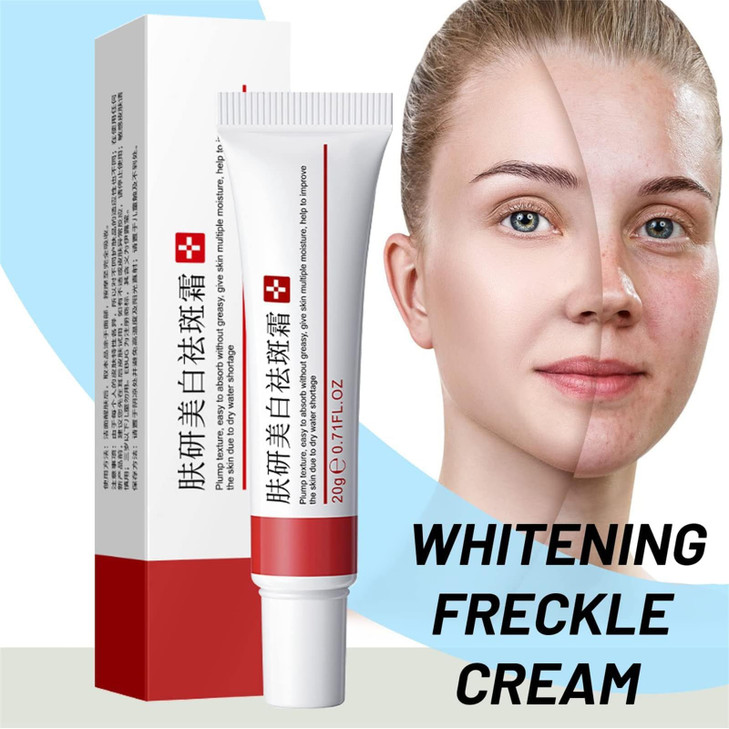 2 Pcs Whitening Freckle Cream Acne Scar Removal Treatment Cream Pigmentation Removal Cream for Face Moisturizing Removes