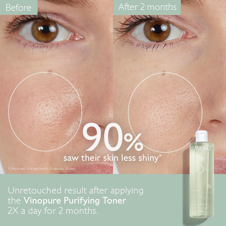 Caudalie Vinopure Natural Salicylic Acid Pore Minimizing Toner 67 Ounce