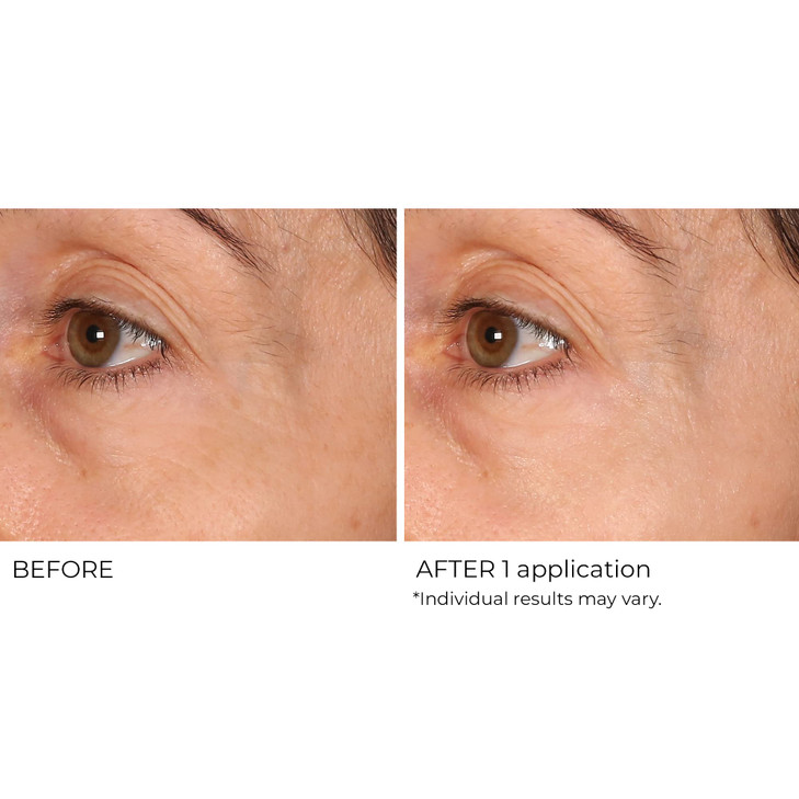 NassifMD Wrinkle Blur Targeted Treatment